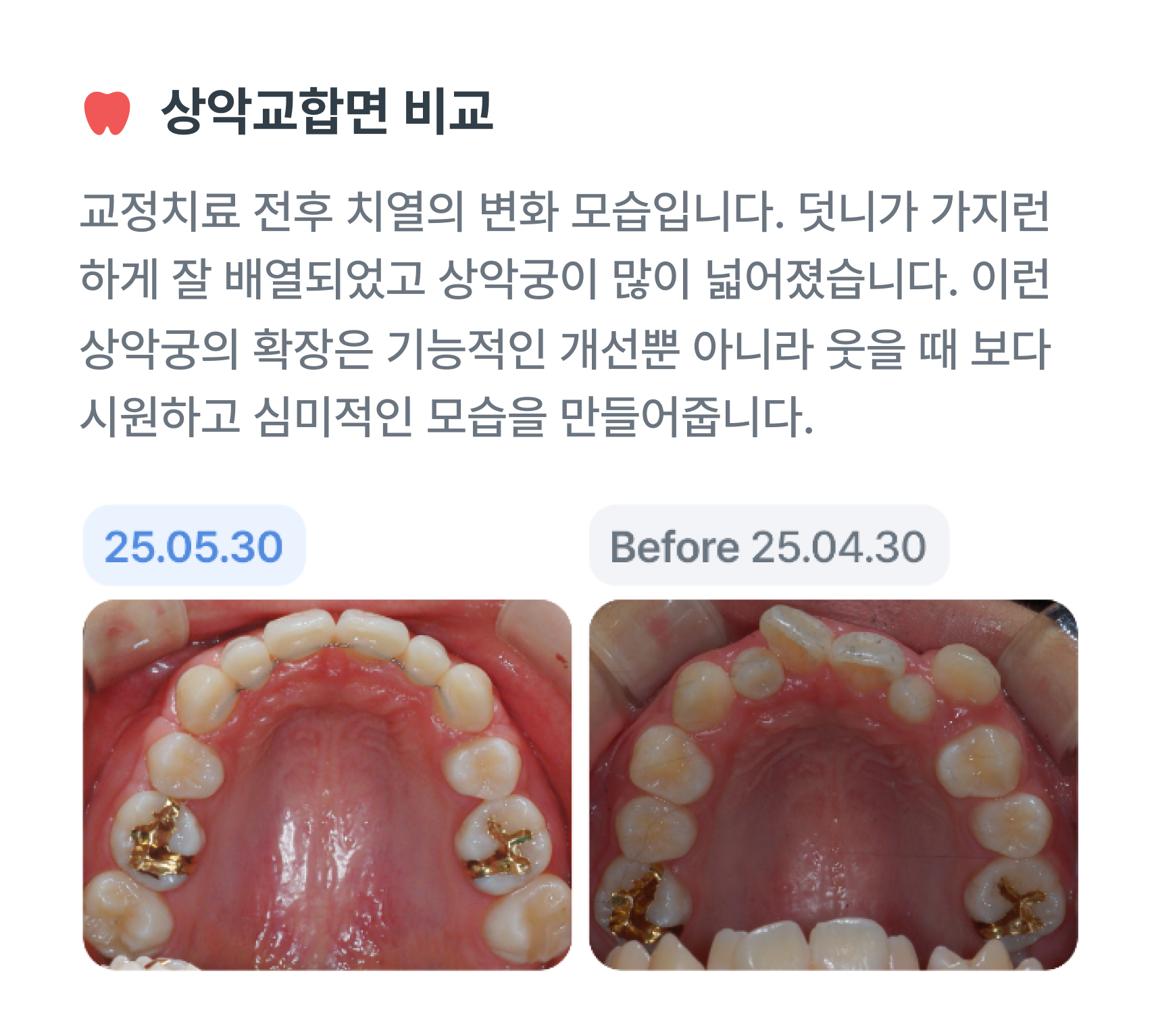 교정 일기